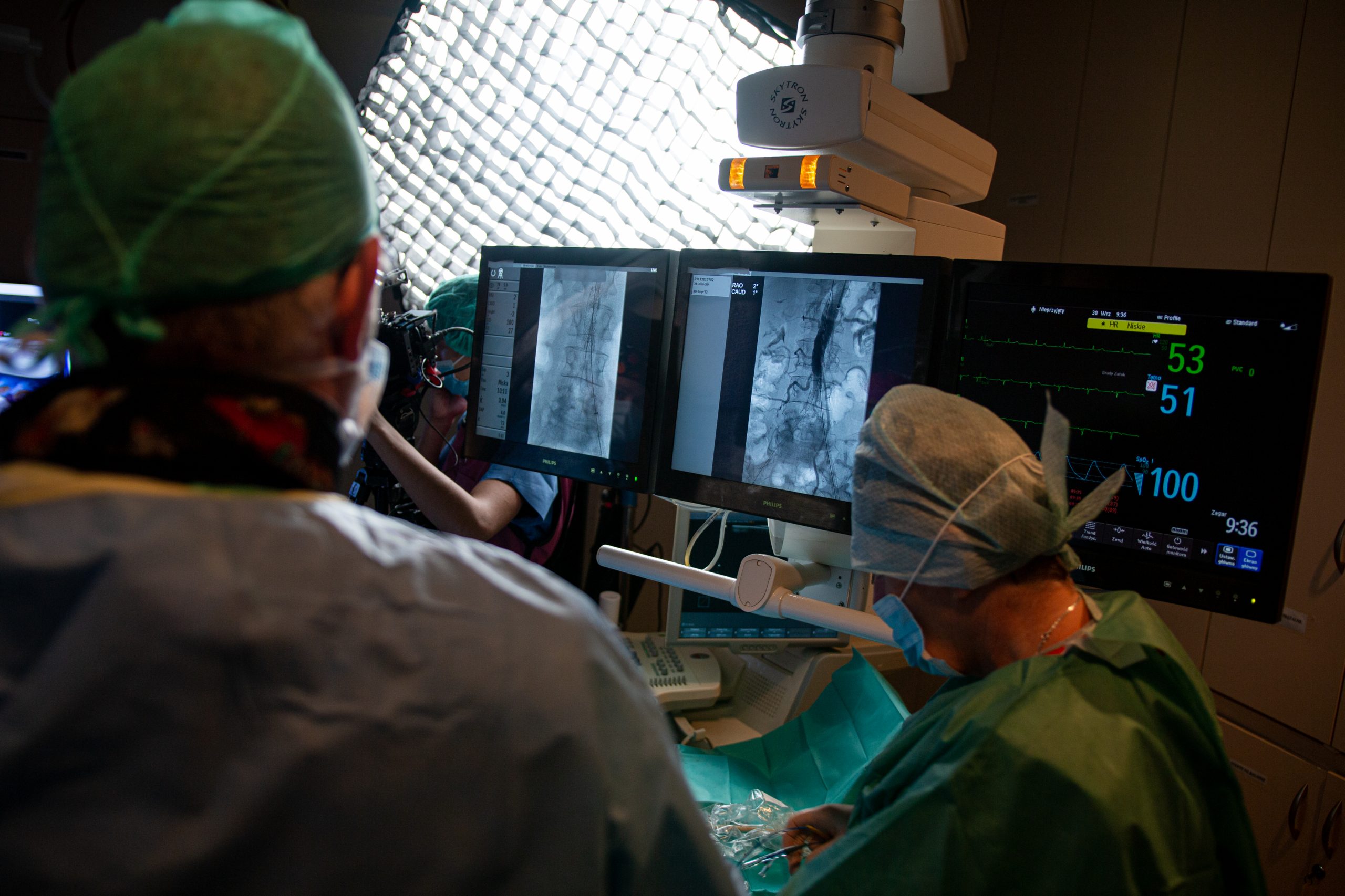 Zdjęcie lekarzy, którzy obserwują co się dzieje na monitorze podczas operacji