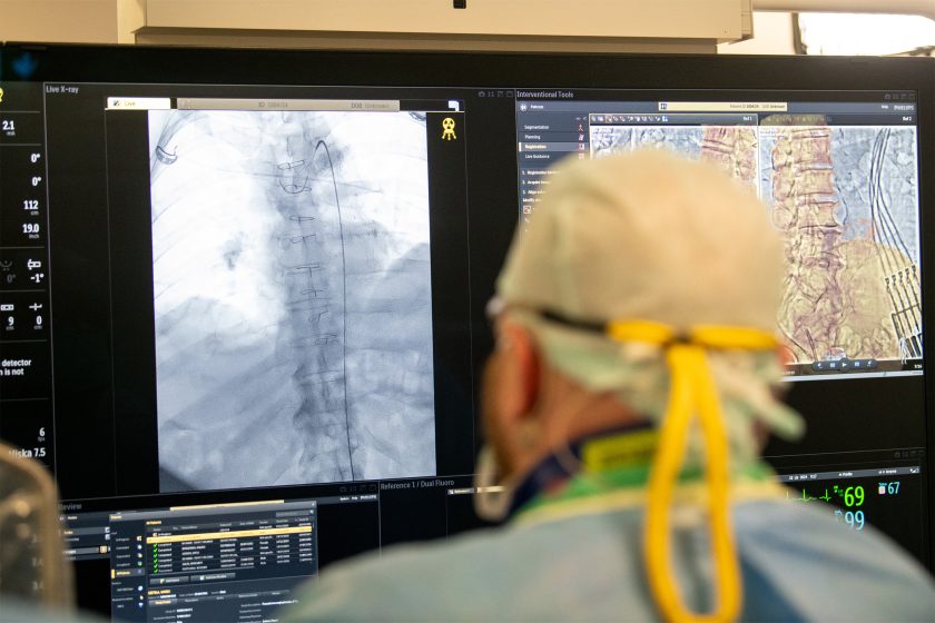 Monitor w sali operacyjnej z wyświetlonymi obrazami diagnostycznymi kręgosłupa i narzędziami używanymi w procedurze. Na pierwszym planie widoczny jest chirurg obserwujący dane