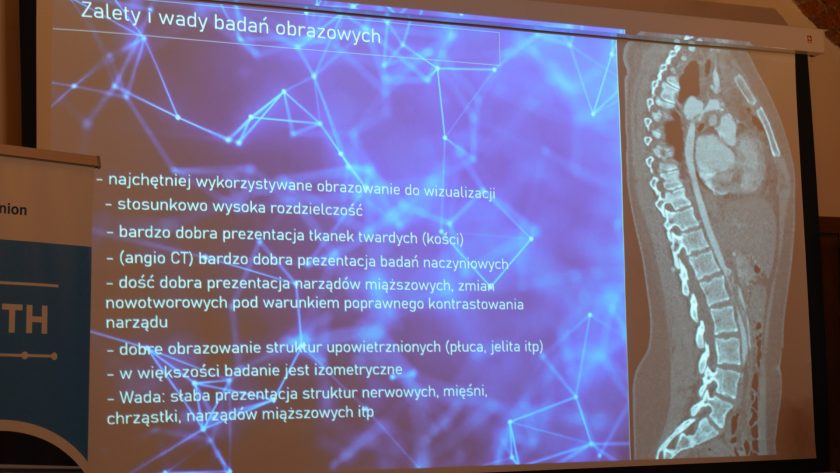 Slajd prezentacji z tytułem „Zalety i wady badań obrazowych” na niebieskim tle z grafiką sieci połączeń. Po prawej widoczny obraz tomografii komputerowej przedstawiający przekrój ludzkiego tułowia. Po lewej stronie tekst omawiający zalety i ograniczenia obrazowania medycznego
