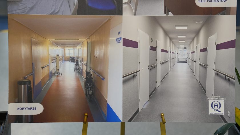 Zbliżenie na dwie plansze zestawiające fotografie „przed” i „po” modernizacji pomieszczeń. Widać między innymi odnowioną dyżurkę pielęgniarek i salę kinezyterapii wyposażoną w nowoczesny sprzęt