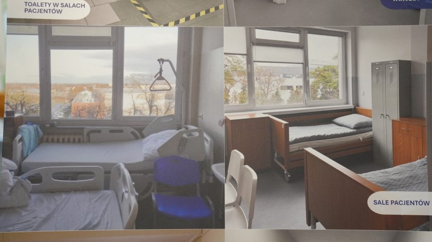 Zbliżenie na dwie plansze zestawiające fotografie „przed” i „po” modernizacji pomieszczeń. Widać między innymi odnowioną dyżurkę pielęgniarek i salę kinezyterapii wyposażoną w nowoczesny sprzęt