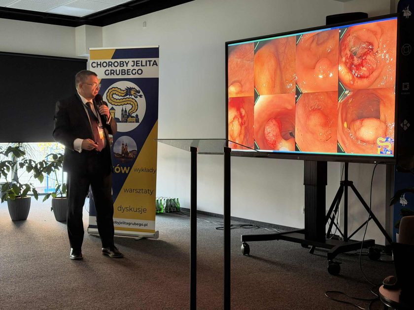 Mężczyzna w garniturze prowadzi wykład, stojąc obok dużego ekranu z obrazami endoskopowymi jelita grubego; z lewej strony widoczny baner wydarzenia „Choroby Jelita Grubego”