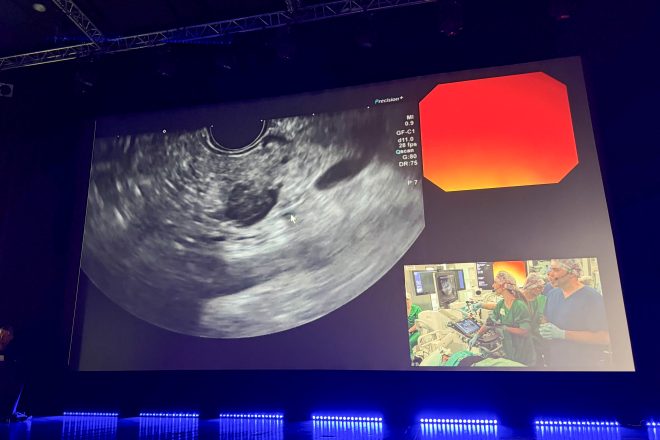 Na dużym ekranie w sali konferencyjnej wyświetlany jest obraz z badania endoskopowego wykonywanego na żywo podczas warsztatów medycznych. W prawym dolnym rogu ekranu widoczny jest zespół lekarzy i personelu medycznego ubranych w zielone stroje operacyjne oraz kolorowe czepki chirurgiczne, pracujących przy aparaturze endoskopowej na sali zabiegowej. Wokół sceny panuje półmrok, a dolna część sceny podświetlona jest niebieskim światłem LED